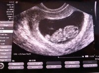 baby b ultrasound.jpg