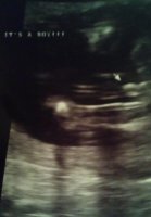 Its a boy 18 weeks.jpg