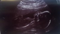 20 week scan.jpg