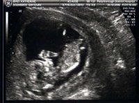 katherines scan picture.jpg