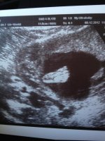 baby foot.jpg