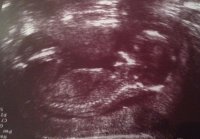 baby 17 weeks.jpg