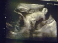 28 week scan 002.jpg