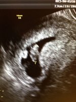 sono_7.5week_small.jpg