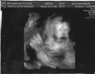 28 week ultrasound.jpeg