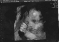 28 week ultrasound foot 1.jpeg