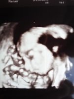 Bean 24wks4d.jpg