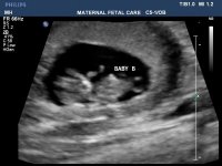 BabyB10weeks.jpg