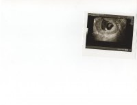 baby.jpg
