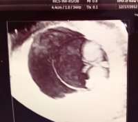 baby8w5din3DSMALL.jpg