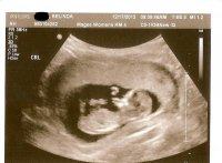 Baby2SecondPic2.jpg