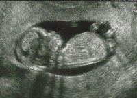 Twin A 12.18.12.jpg