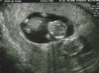 Twin B 12.18.12.jpg