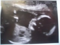 19w 6d GIRL.jpg