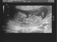 Baby.jpg