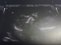 13 week scan.jpg