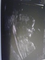 baby dixon due July 2013.jpg