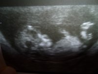 baby number 2.jpg
