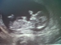 13 Week Ultrasound.jpg