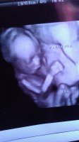 baby18w1#1.jpg