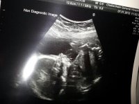 baby scan 2.jpg