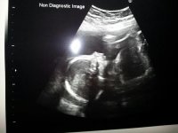 baby scan..2.jpg