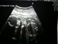 baby scan.2.jpg