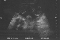 Baby B 14 week US.jpg
