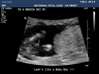 TwinsA14weeksBOY1.jpg