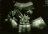 19w6d ITS A BOY.jpg