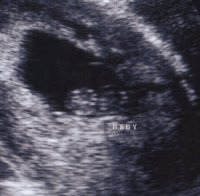 11Baby09012013.JPG