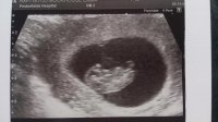 9weeks.jpg