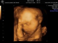 24 week-4D pic (3).jpg