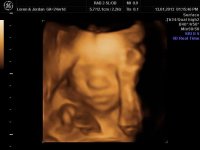 24 week-4D pic (4).jpg