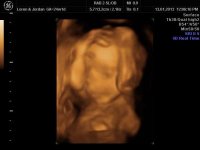 24 week-4D pic (5).jpg