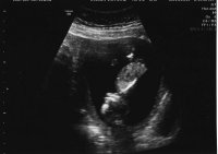 13 Week Scan Post.jpg