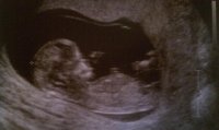 Baby! 12 W 4.jpg