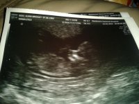 Scan pic - 12weeks.jpg