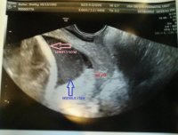 Cervix 10-18-12 #2.jpg