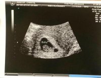 baby #2.jpg