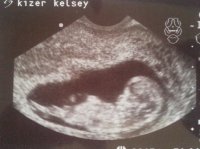 11weeks3.jpg