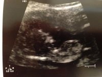 12 week scan 02 01 2013.jpg