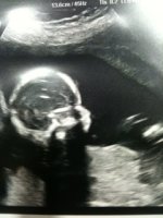 18 weeks 1 day.JPG