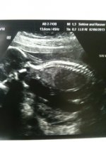 18 weeks 1 day A.JPG