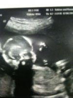 18 weeks 1 day B.JPG