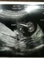 18 weeks 1 day C.JPG