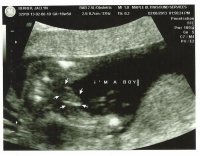 Im a boy!.jpg