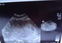 bump2.jpg