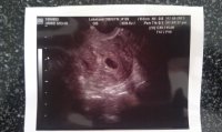 5 weeks 2.jpg