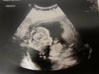 ITSAGIRL.jpg